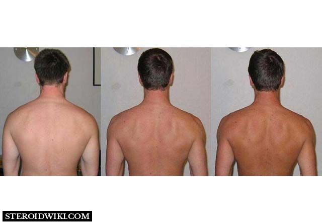 Before and after of Melanotan II