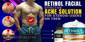 The Ultimate Guide to Retinol: Benefits for Acne and Skin Care