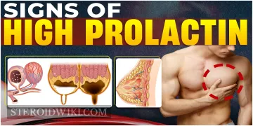 Signs of High Prolactin