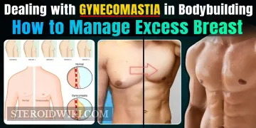 Dealing with Gynecomastia in Bodybuilding: How to Manage Excess Breast Tissue