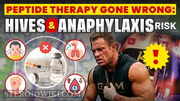 Peptide Therapy Gone Wrong: Hives and Anaphylaxis Risks